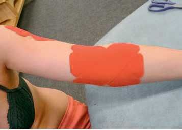 Дмитрий Киселев - Кинезиотейпинг в лечебной практике неврологии и ортопедии