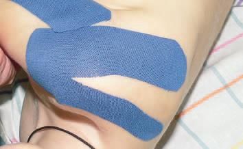 Дмитрий Киселев - Кинезиотейпинг в лечебной практике неврологии и ортопедии