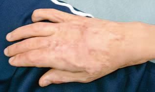 Дмитрий Киселев - Кинезиотейпинг в лечебной практике неврологии и ортопедии