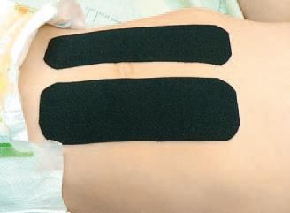 Дмитрий Киселев - Кинезиотейпинг в лечебной практике неврологии и ортопедии