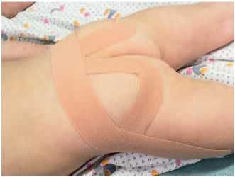 Дмитрий Киселев - Кинезиотейпинг в лечебной практике неврологии и ортопедии