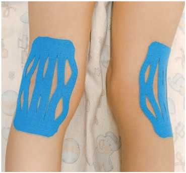 Дмитрий Киселев - Кинезиотейпинг в лечебной практике неврологии и ортопедии