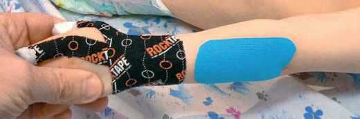 Дмитрий Киселев - Кинезиотейпинг в лечебной практике неврологии и ортопедии