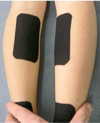 Дмитрий Киселев - Кинезиотейпинг в лечебной практике неврологии и ортопедии