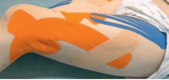 Дмитрий Киселев - Кинезиотейпинг в лечебной практике неврологии и ортопедии