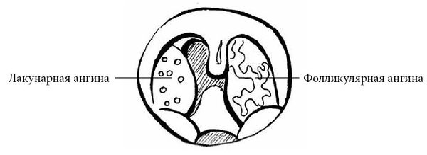 Андрей Яловчук - Если ваш ребенок заболел. Что должны знать и уметь родители