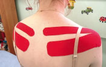 Дмитрий Киселев - Кинезиотейпинг в лечебной практике неврологии и ортопедии