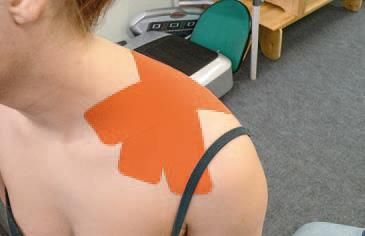 Дмитрий Киселев - Кинезиотейпинг в лечебной практике неврологии и ортопедии