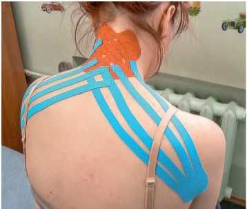 Дмитрий Киселев - Кинезиотейпинг в лечебной практике неврологии и ортопедии