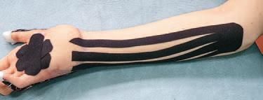 Кинезиотейпинг в лечебной практике...