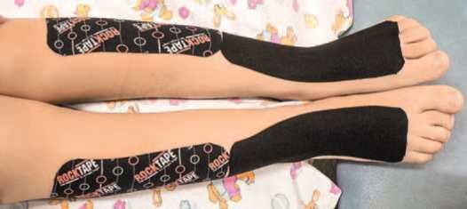 Дмитрий Киселев - Кинезиотейпинг в лечебной практике неврологии и ортопедии