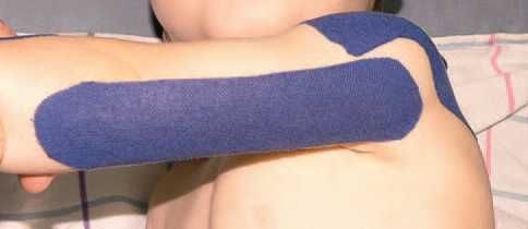 Дмитрий Киселев - Кинезиотейпинг в лечебной практике неврологии и ортопедии