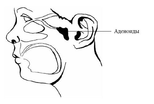 Андрей Яловчук - Если ваш ребенок заболел. Что должны знать и уметь родители