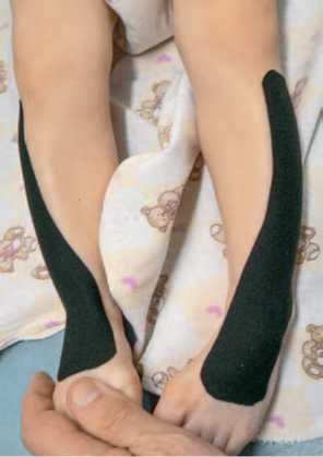 Дмитрий Киселев - Кинезиотейпинг в лечебной практике неврологии и ортопедии