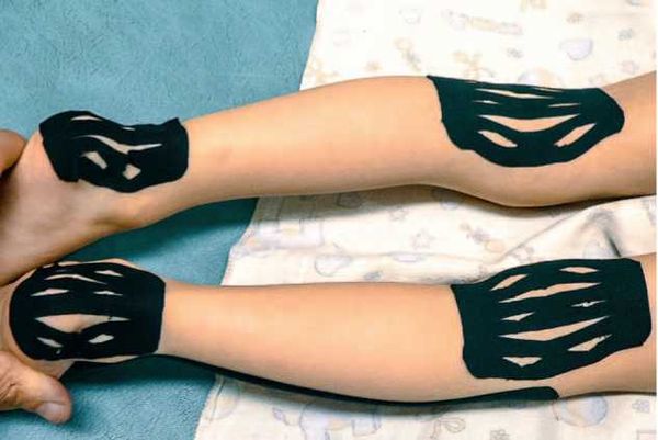 Дмитрий Киселев - Кинезиотейпинг в лечебной практике неврологии и ортопедии