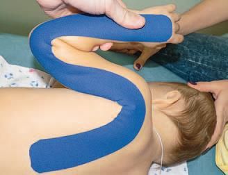 Дмитрий Киселев - Кинезиотейпинг в лечебной практике неврологии и ортопедии