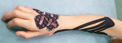 Кинезиотейпинг в лечебной практике...