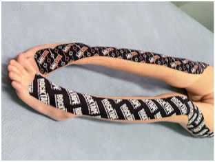 Дмитрий Киселев - Кинезиотейпинг в лечебной практике неврологии и ортопедии