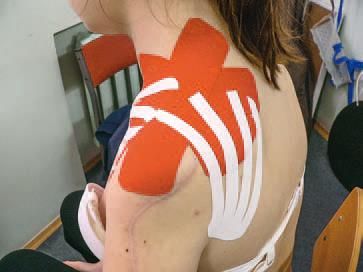 Дмитрий Киселев - Кинезиотейпинг в лечебной практике неврологии и ортопедии