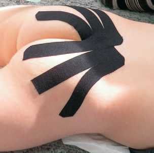 Дмитрий Киселев - Кинезиотейпинг в лечебной практике неврологии и ортопедии