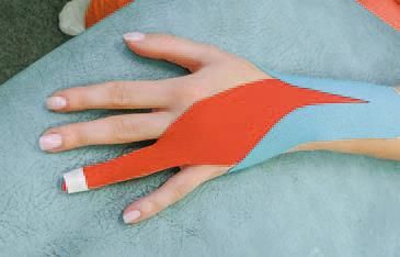 Дмитрий Киселев - Кинезиотейпинг в лечебной практике неврологии и ортопедии