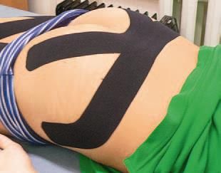 Дмитрий Киселев - Кинезиотейпинг в лечебной практике неврологии и ортопедии