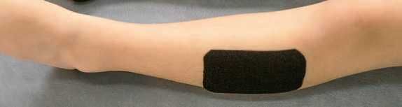 Дмитрий Киселев - Кинезиотейпинг в лечебной практике неврологии и ортопедии