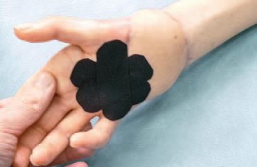 Дмитрий Киселев - Кинезиотейпинг в лечебной практике неврологии и ортопедии