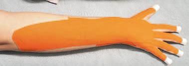 Кинезиотейпинг в лечебной практике...