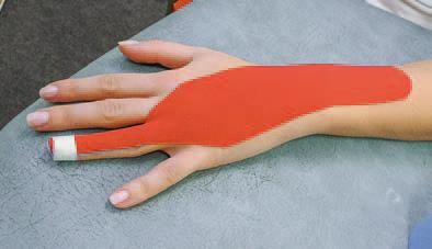 Дмитрий Киселев - Кинезиотейпинг в лечебной практике неврологии и ортопедии