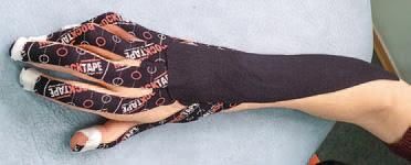 Кинезиотейпинг в лечебной практике...