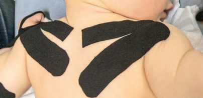 Дмитрий Киселев - Кинезиотейпинг в лечебной практике неврологии и ортопедии