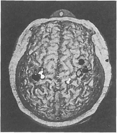 Вилейанур Рамачандран - Мозг рассказывает. Что делает нас людьми