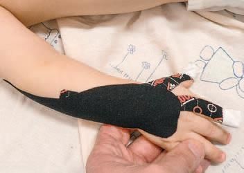 Дмитрий Киселев - Кинезиотейпинг в лечебной практике неврологии и ортопедии