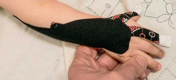 Дмитрий Киселев - Кинезиотейпинг в лечебной практике неврологии и ортопедии