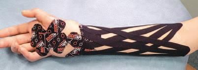 Кинезиотейпинг в лечебной практике...