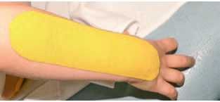 Кинезиотейпинг в лечебной практике...