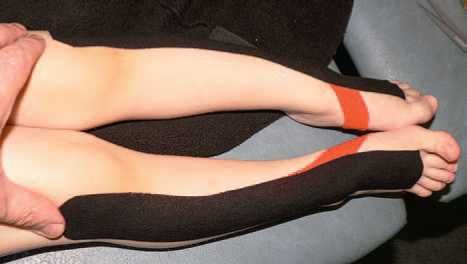 Дмитрий Киселев - Кинезиотейпинг в лечебной практике неврологии и ортопедии