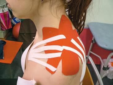 Дмитрий Киселев - Кинезиотейпинг в лечебной практике неврологии и ортопедии