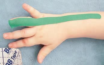 Дмитрий Киселев - Кинезиотейпинг в лечебной практике неврологии и ортопедии