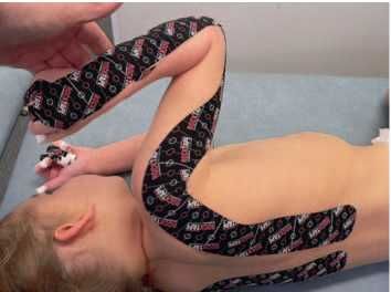 Дмитрий Киселев - Кинезиотейпинг в лечебной практике неврологии и ортопедии