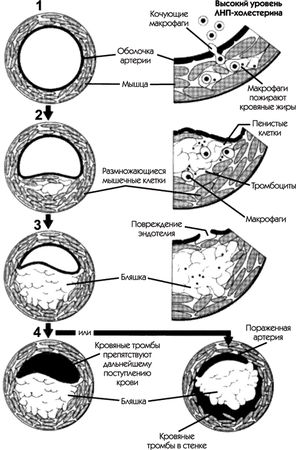 Константин Крулев - Инсульт. Жизнь до и после