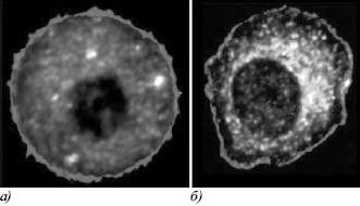 Михаил Кутушов - Зеркальные болезни. Рак, диабет, шизофрения, аллергия