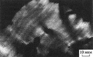 Михаил Кутушов - Зеркальные болезни. Рак, диабет, шизофрения, аллергия