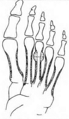 Джозеф Хавилер - Тело танцора
