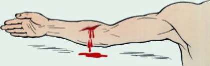 Методичка по оказанию первой помощи