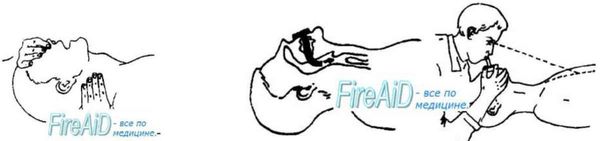 Методичка по оказанию первой помощи