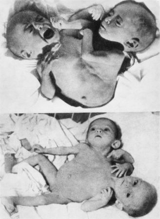 Николай Непомнящий - Люди-феномены