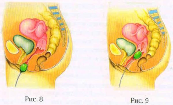 Евгения Фролова - Искусство управления интимными мышцами. Секреты великих...