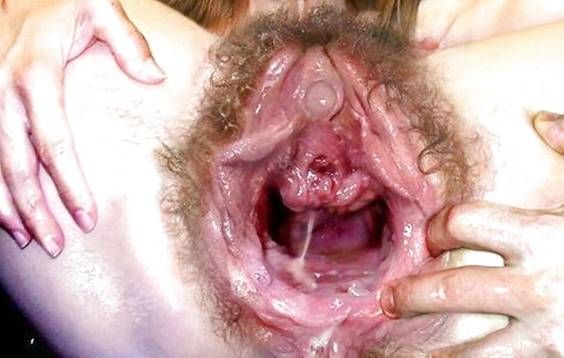 Серж Погорелый - Очень глубокий фистинг с илюстрациями (v.2) 2017г